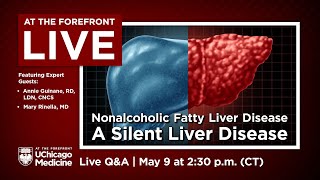 Nonalcoholic Fatty Liver Disease  A Silent Liver Disease  Expert QampA [upl. by Teeter]