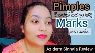 🦋 Azelaic Acid  Aziderm Sinhala Honest Review 🦋 [upl. by Festa277]