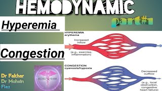 Hemodynamic disorder part  1 Hyperemia and congestion [upl. by Niuqaoj]