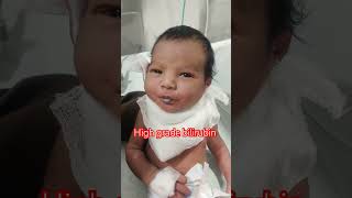 High grade bilirubin nicu reels niculife newbornbaby cute cutebaby [upl. by Aniraad662]