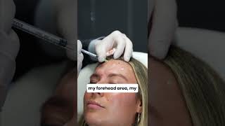 Fillers and Botox I Post Treatment [upl. by Reinhold]