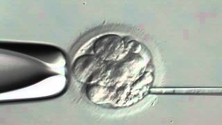 INSTITUT MARQUÈS  Embryo Fragment Removal  IVF [upl. by Nailil]