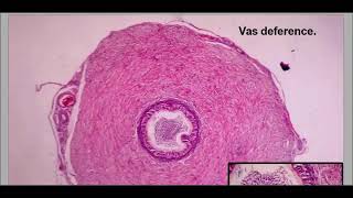 Practical Reproductive maleamp female systems histology [upl. by Compton]