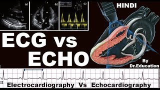 Rx Heart epi 16 h  ECG vs ECHO HINDI Electrocardiography vs Echocardiography DrEducation [upl. by Annairda838]