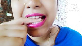 finger biting challenge video bengalivlog love [upl. by Crandale936]