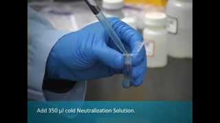 PureYield™ Plasmid Miniprep  Promega [upl. by Netsoj342]