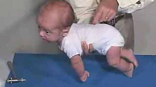 Neurology Exam 3 Month Primitive ReflexesGalant [upl. by Orsay27]