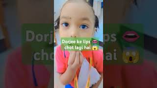 Dorjee buchari ko kal school 🏫🎒 me chot lag gaya hai please commen like karo ap log ki dorjee ko 😱😍💞 [upl. by Monjo179]