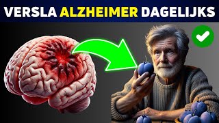 De 7 Beste Dagelijkse Gewoonten om Je Hersenen tegen Alzheimer te Beschermen [upl. by Kristan767]