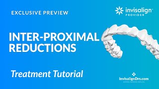 IPR with Invisalign Treatment [upl. by Rajewski]