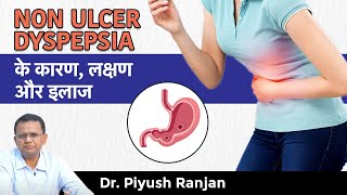 Non Ulcer Dyspepsia क्या होता है  Symptoms and Treatment in Hindi  Gastro Liver Clinic In Delhi [upl. by Icyaj652]