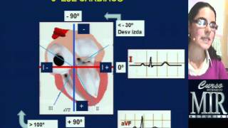 Cómo interpretar un ECG repaso [upl. by Dyob]