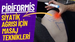 Tetik Nokta Masajı ile Siyatik Ağrısından Kurtul Piriformis ve Gluteus Kaslarının Sırrı [upl. by Philippine]