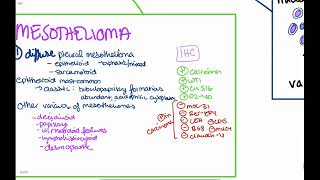 Psammoma Bodies For USMLE Step 1 [upl. by Domeniga]