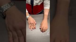 Silicone Prosthetic Hand [upl. by Anilemrac]