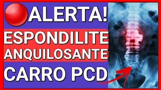 COMO A ESPONDILITE ANQUILOSANTE DÁ DIREITO AO CARRO PCD [upl. by Adair638]