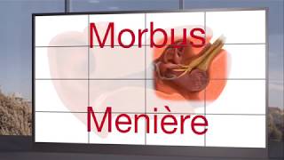 Morbus Menière [upl. by Crowns220]