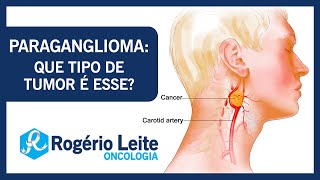 Paraganglioma que tipo de tumor é esse  Dr Rogério Leite [upl. by Baniez237]