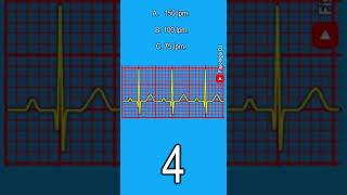 Electrocardiograma interpretación  ¿Frecuencia cardíaca en este ejemplo utilizando el intervalo RR [upl. by Collette]