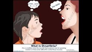 What is Dysarthria [upl. by Aicatsana40]