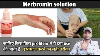 Merbromin solution use benefits and Side effects full review in hindi [upl. by Kristos]