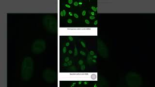 Fluorescence firstaidusmle neetpg inicet usmle usmlestep rheumatology mnemonics [upl. by Eanerb220]