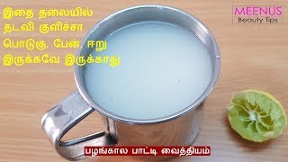 பொடுகு பேன் ஈறு நீங்க எளிமையான வழி  Dandruff Home Remedy in Tamil [upl. by Aedni]