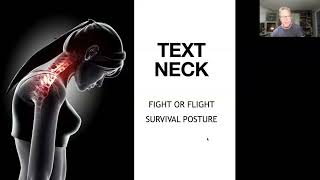 Text Neck Platysma Muscle Exercise [upl. by Latrena]