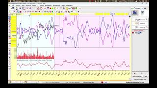 Timing Solution  Banknifty Analysis with Square of 9  Intraday amp positional  Gannzilla Trade [upl. by Konrad527]