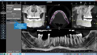 Acteon Imaging Suite 50 Full Software Training Video with Lee Davis [upl. by Quirk]