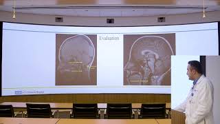 “Common Pitfalls in Chiari Operations”  Aria Fallah MD [upl. by Torruella]