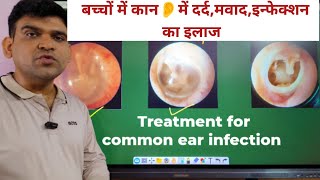 Ear 👂 Infection ka ilaz in hindi drniteshraj कान में दर्द मवाद आना Types of ear drops 💧 and uses [upl. by Ahtnama]