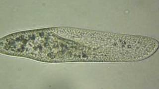 Paramecium caudatum [upl. by Abita]