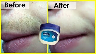 Permanently Remove Unwanted Hair at Home  The Hair will never grow again [upl. by Anneyehc]