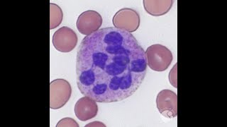 Hypersegmented neutrophils [upl. by Mullane682]