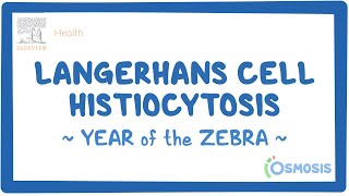 Langerhans cell histiocytosis Year of the Zebra [upl. by Oremor77]