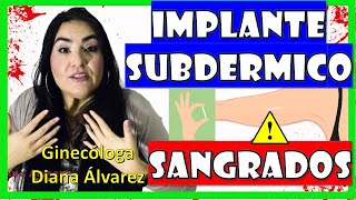 SANGRADOS con IMPLANTE SUBDERMICO ¿Por Qué ¿Qué Hacer por GINECOLOGA DIANA ALVAREZ [upl. by Mariken]