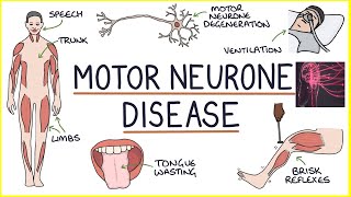 🩺What are Motor Neuron Diseases❓ They are a type of nerve cell 🔴You have two main types🔴 [upl. by Anahsal]