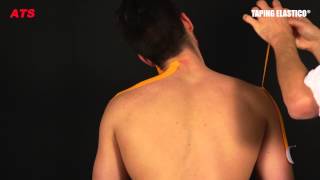 Taping Elastico®  Applicazione Cervicale [upl. by Leyes]