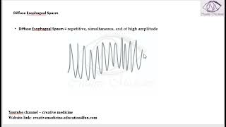 Lec 1 Diffuse Esophageal Spasm mp4 [upl. by Nyrahs843]