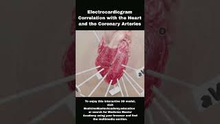 Electrocardiogram Correlation ecg heart stemi nstemi heartattack ekg electrocardiogram [upl. by Griffie453]