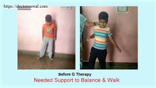 Leukodystrophy treatment  Dr Oswals G Therapy  Leucodistrofia Leukodystrophie حثل المادة البيضاء [upl. by Tegdig]