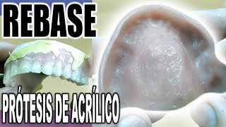 CÓMO HACER UN REBASE A UNA PRÓTESIS DENTAL DE ACRÍLICO PASO A PASO [upl. by Fredelia29]