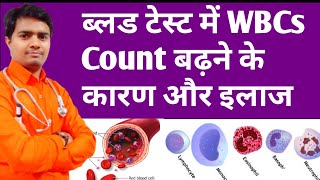 High Wbcs Count In Blood  ब्लड में WBCs बढ़ने के कारण और इलाज  High Wbc Count Treatment In Hindi [upl. by Goltz]