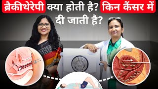 ब्रैकीथेरेपी क्या होती हैकिन कैंसर में दी जाती हैWhat is Brachytherapy Is Brachytherapy Painful [upl. by Fair863]