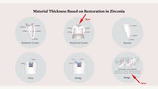 Zirconia 101 3 of 11 Preparation Indications for zirconia [upl. by Enwahs]