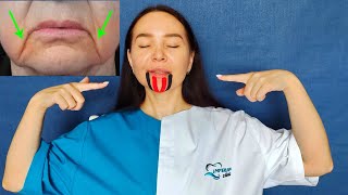 HOW to get rid of Marionette Lines and Lift up Lips corners with Face Taping [upl. by Llabmik]