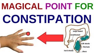 ACUPRESSURE POINTS For CONSTIPATION Constipation And GAS  Constipation And PILES [upl. by Annovad]