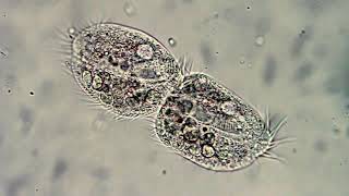 Microorganismos Protozoos Paramecio vorticela Euglena Diatomeas [upl. by Mutua602]