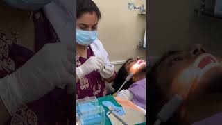 Scaling Done Followed by Caries Removal and Filling in Teeth [upl. by Zolly]